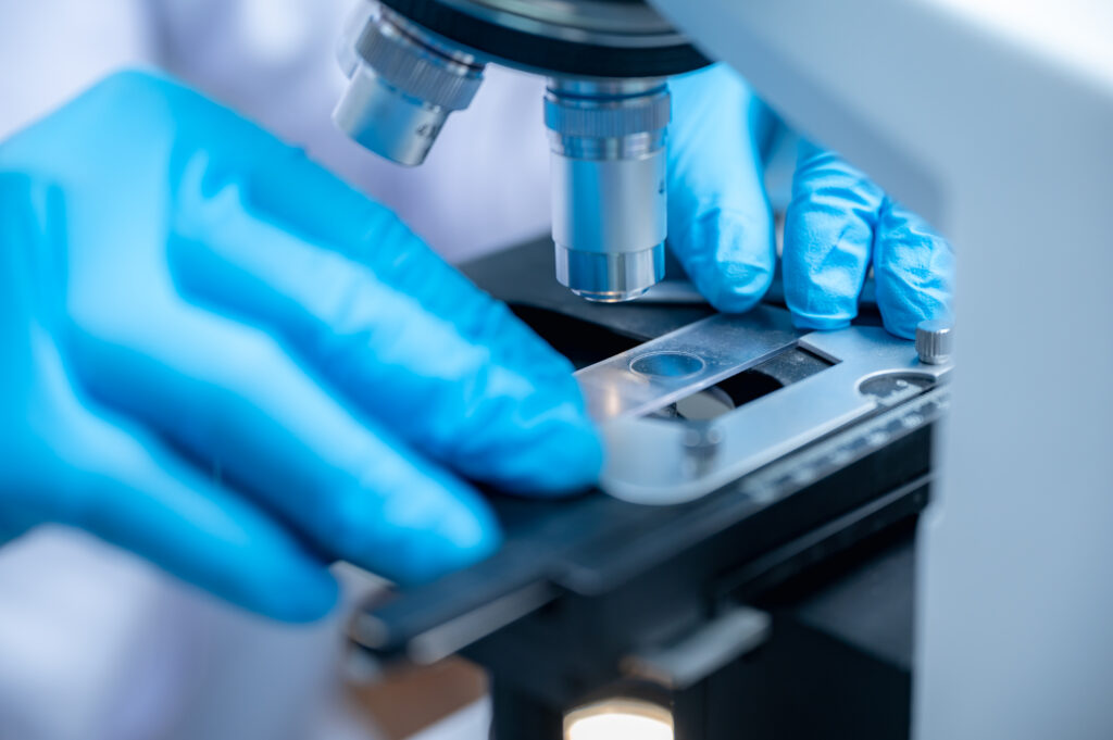 Nanocurcumin Solusi Turunkan Resiko Kanker
