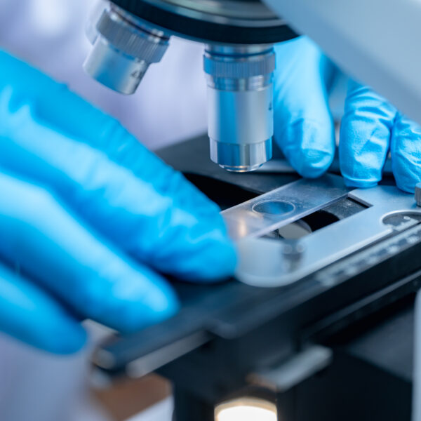 Nanocurcumin Solusi Turunkan Resiko Kanker