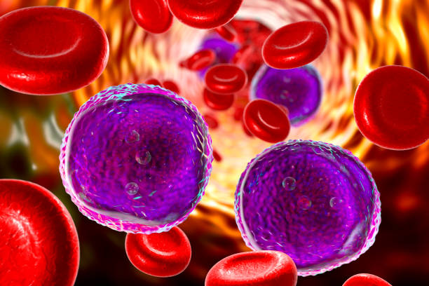 ekstrak kunyit mengobati leukemia